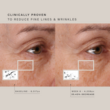 HigherDOSE Red Light Face Mask - MASK-V1
