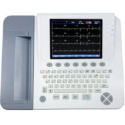 Edan SE-1200 Express Basic 12-Channel ECG - EDN-SE-1200EB