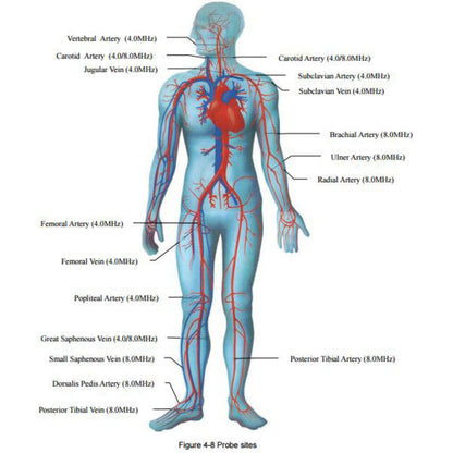 Edan SonoTrax II Fetal Doppler Baby Heart Monitor - EDN-ST2-03