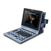 Edan U60 Vet Diagnostic Ultrasound System - EDN-U60-Vet