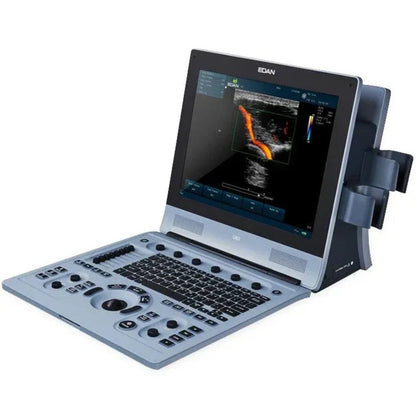 Edan U60 Color Doppler Ultrasound - EDN-U60-Mainunit