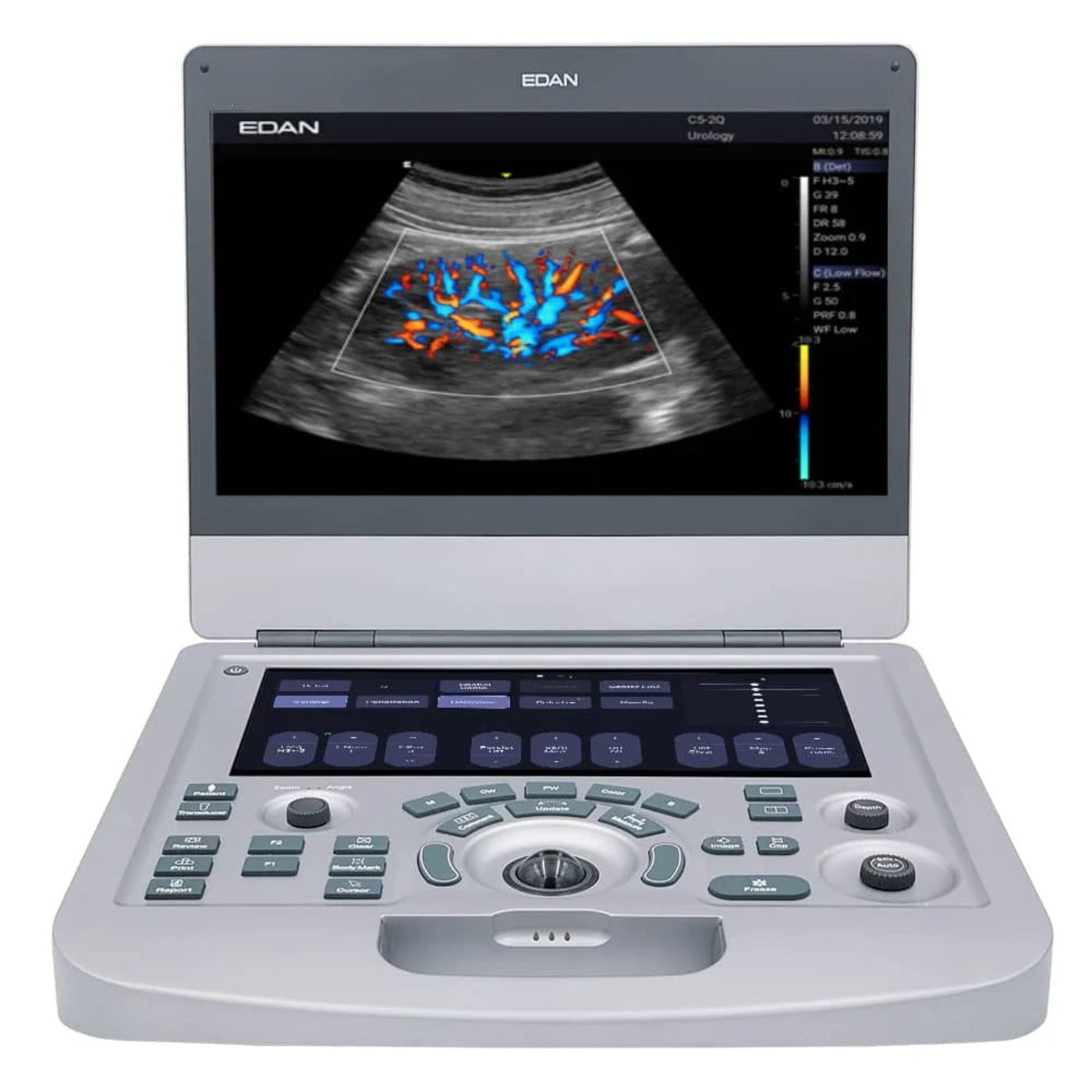 Edan Acclarix AX3 Compact Color Doppler Ultrasound System -  EDN-AX3