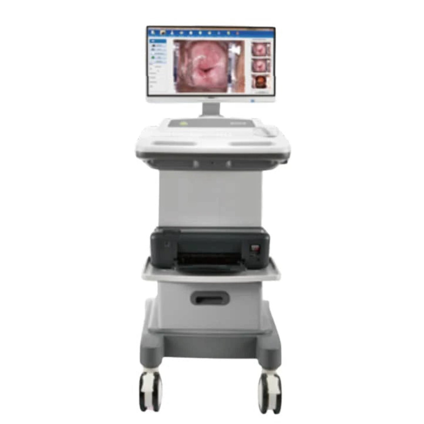 Edan C6A HD Video Colposcope - EDN-C6AHD-Arm